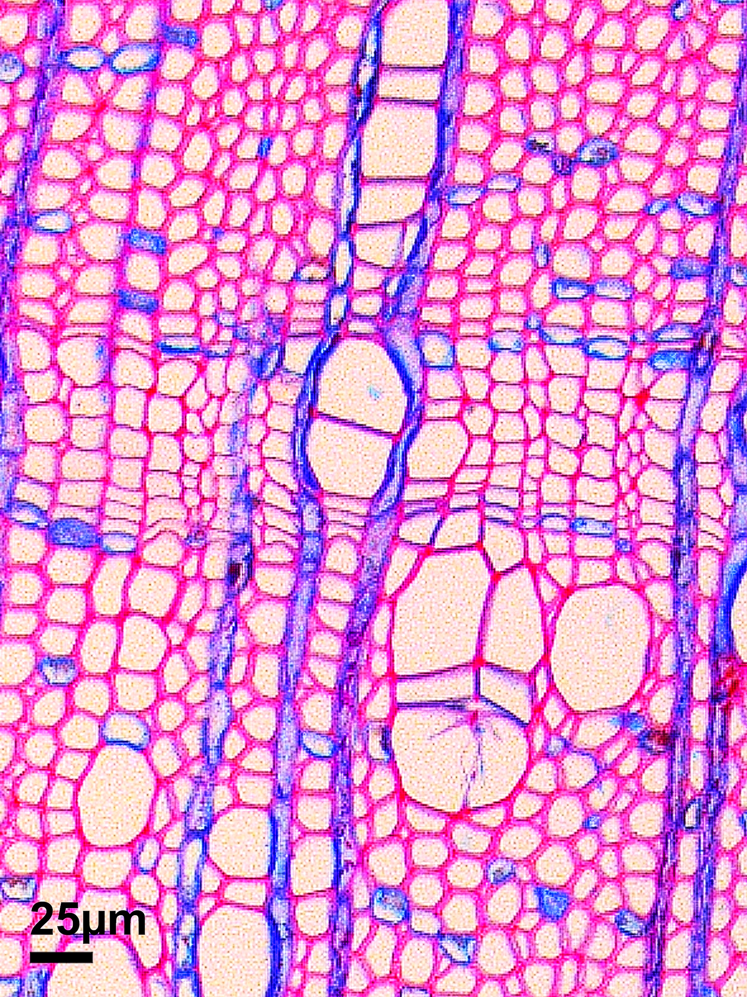 Dünnschnitt einer arktischen Erle. Nur sechs Zellen bilden das dünne Band in der Mitte, den Jahrring 2004, das Jahr einer Motteninvasion. – Foto: Jelena Lange
