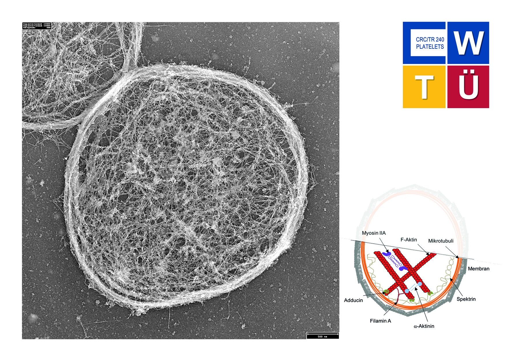 Im Rahmen des Projekts wurde anhand neu entwickelter biophysikalischer Methoden gezeigt, dass das Zellskelett von Thrombozyten in seiner Funktion, Kräfte auszuüben, eingeschränkt ist. © Uniklinik Würzburg