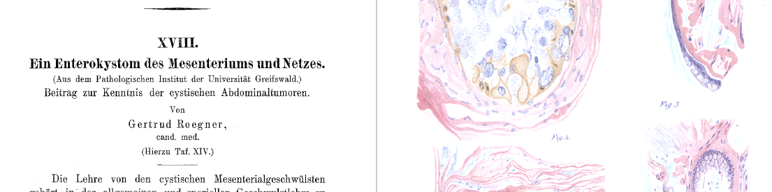 Vor 120 Jahren: 1. Frau promoviert an UG