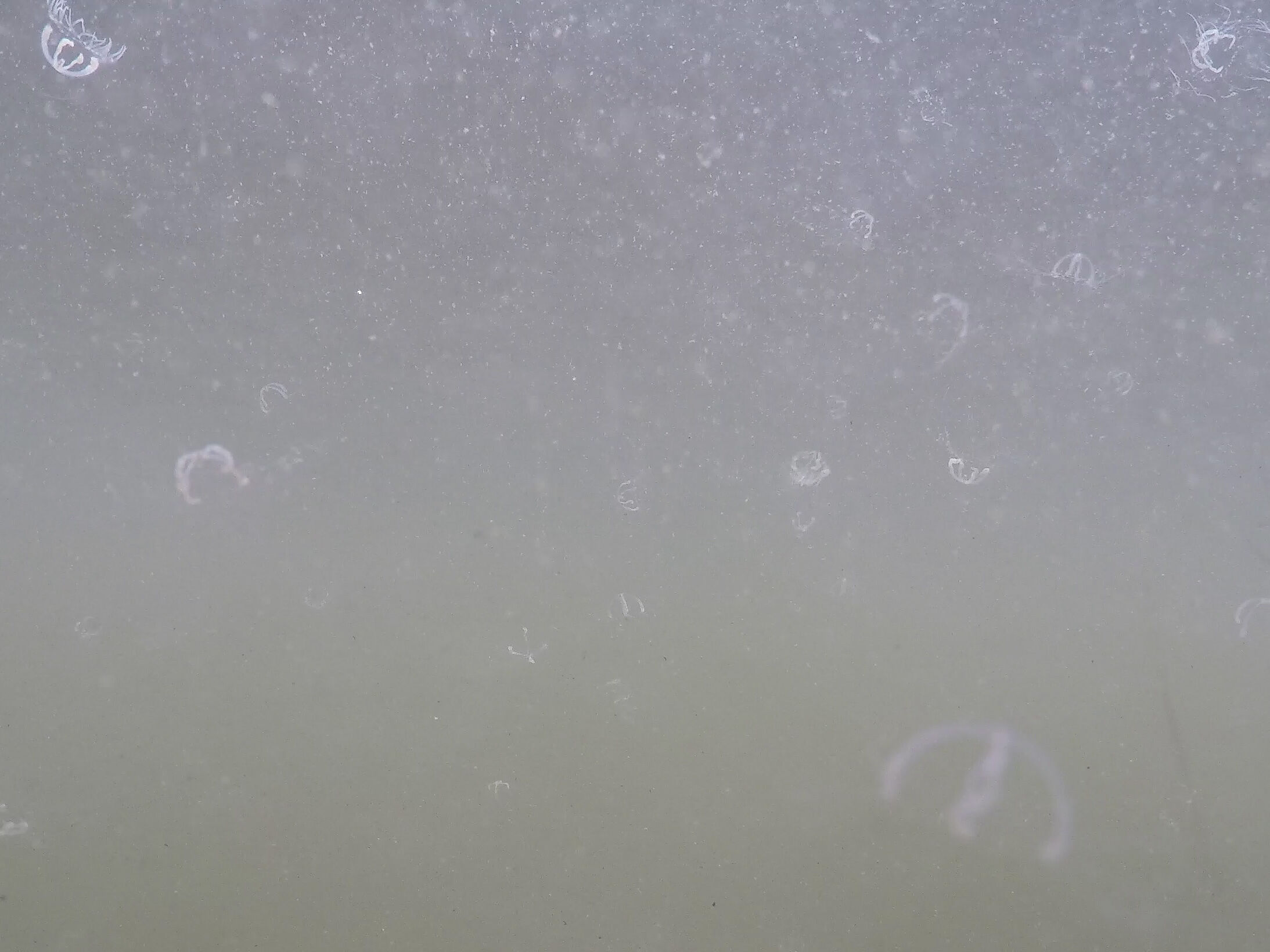 Snapshot aus einem Unterwasservideo einer „Quallenwolke“ – Copyright: Dr. Sven Dahlke, Biologische Station Hiddensee
