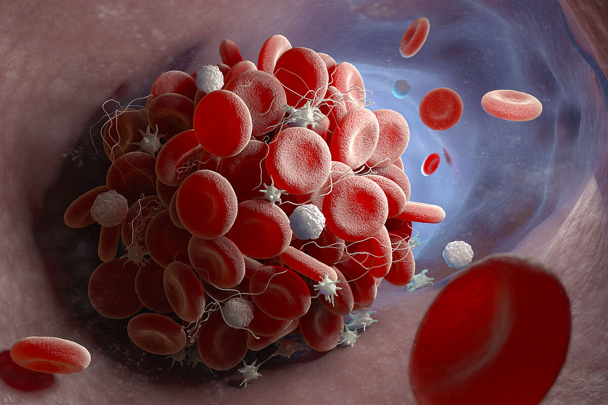  3D-Illustration of a blood clot, with a number of red blood cells forming a ball and then slowly breaking up.