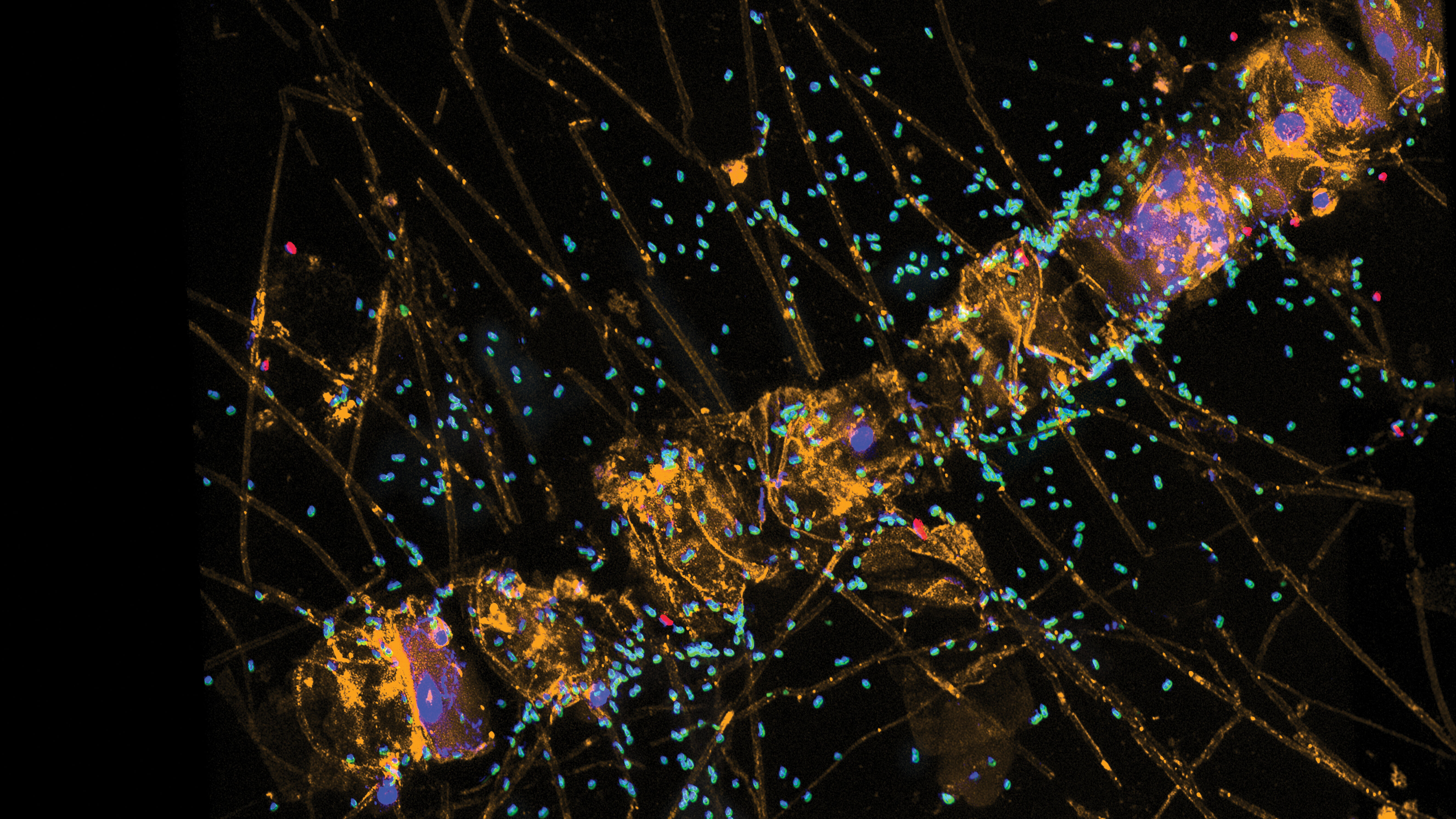 Polysaccharide-degrading bacteria (green) on the diatom Chaetoceros sp. – photo: I. Bakenhus / Max Planck Institute for Marine Microbiology, Bremen