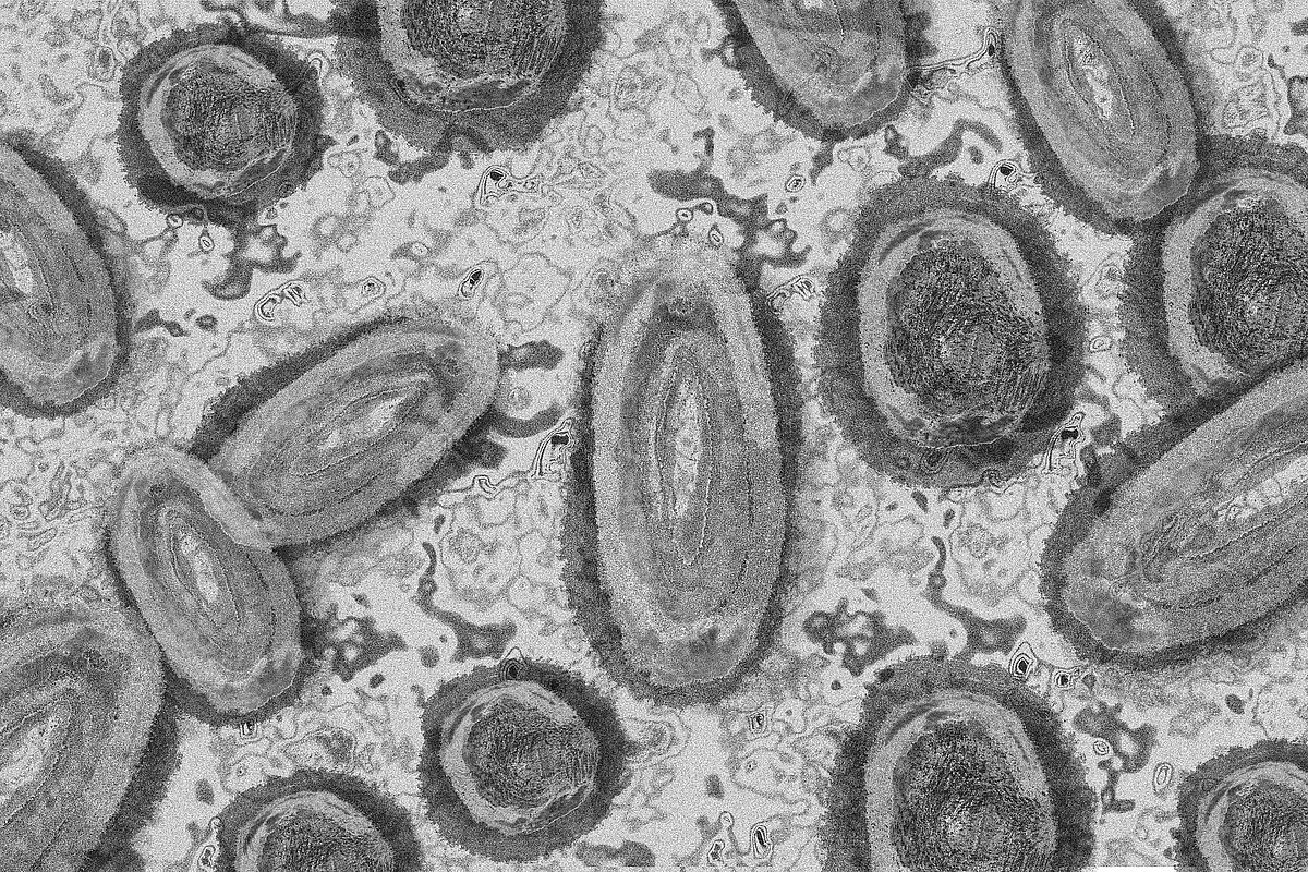 Affenpockevirus aus Mikroskopsicht, ©Pixabay