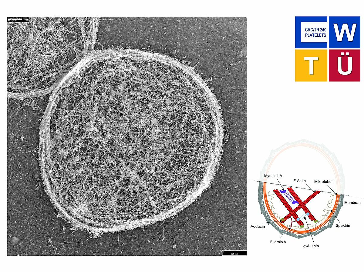 Within the framework of the project, newly developed biophysical methods were used to show that the cytoskeleton of platelets is limited in its function to exert force. © University Hospital Würzburg