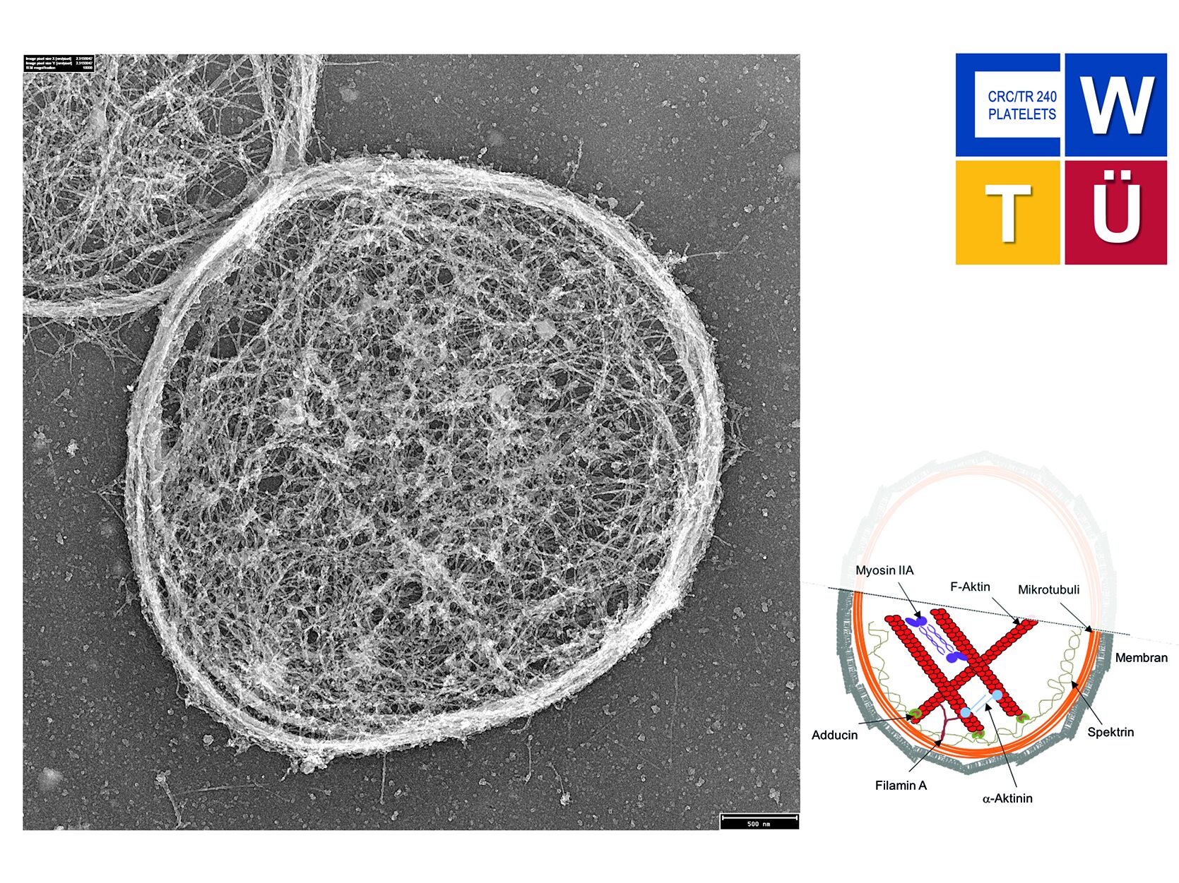 Within the framework of the project, newly developed biophysical methods were used to show that the cytoskeleton of platelets is limited in its function to exert force. © University Hospital Würzburg
